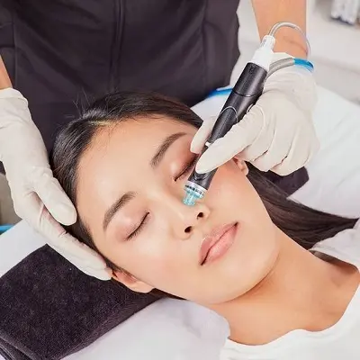 Dermatologists Reveal Why Some Acne Treatments Fail