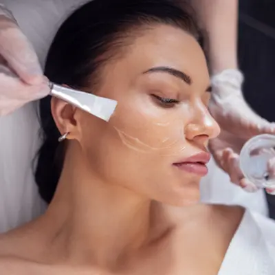 Understanding the Science Behind Chemical Peels
