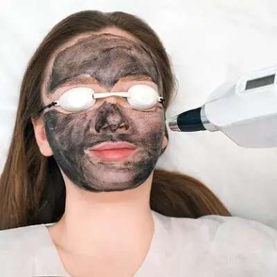 Is Laser Carbon Peel Painful? Honest Answers