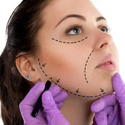 Can Cosmetic Surgery Be Reversed? What to Know