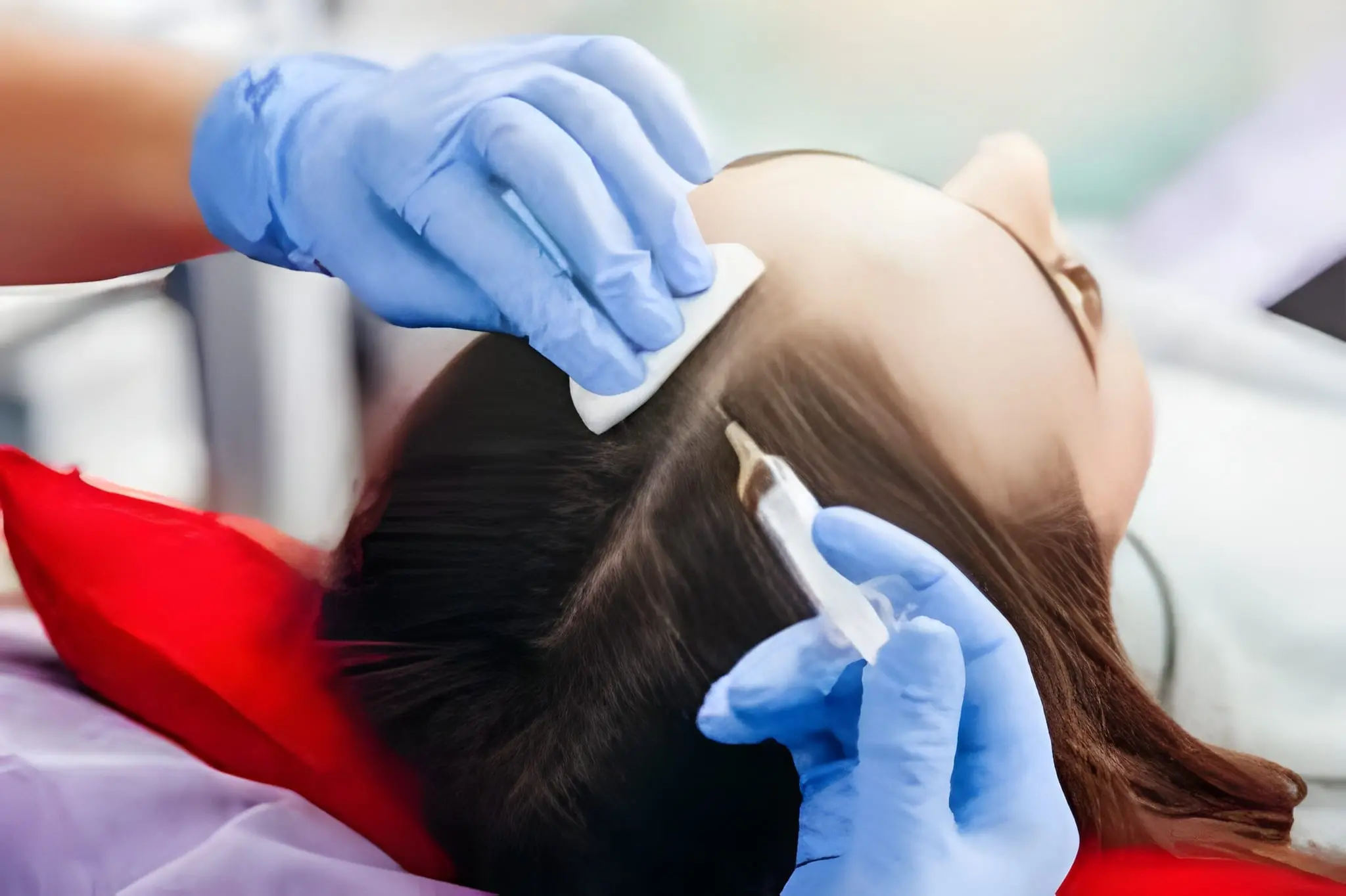 PRP Treatment