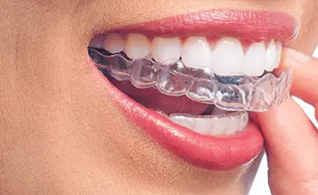 Invisalign