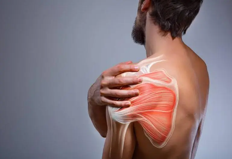 Shoulder Instability