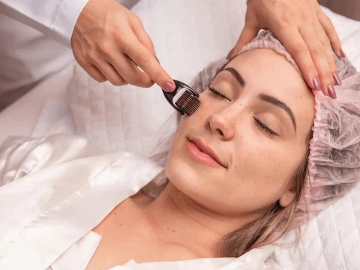 Derma Roller Treatment