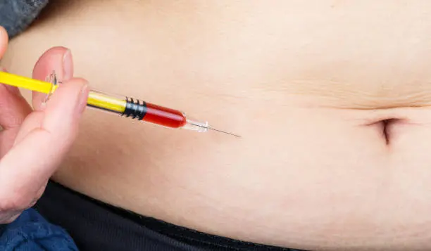 Who Is a Good Candidate for Fat Transfer Surgery?