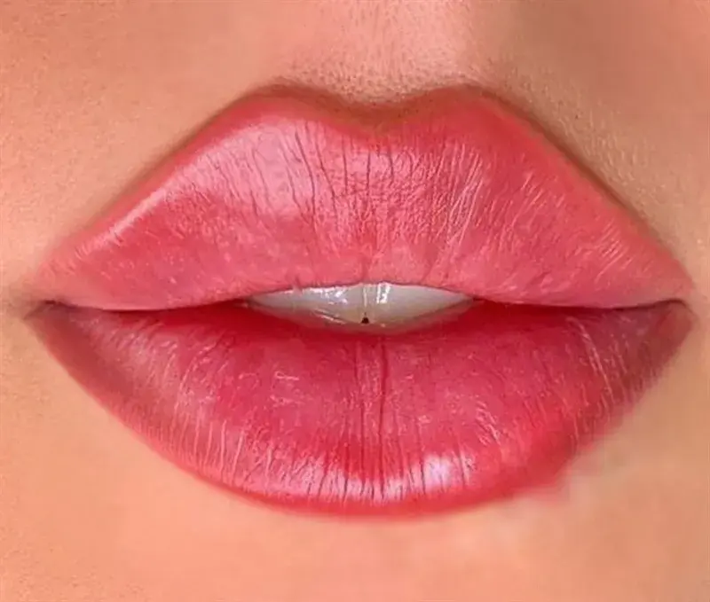 Can Russian Lip Filler create youthful plump lip revival effect?