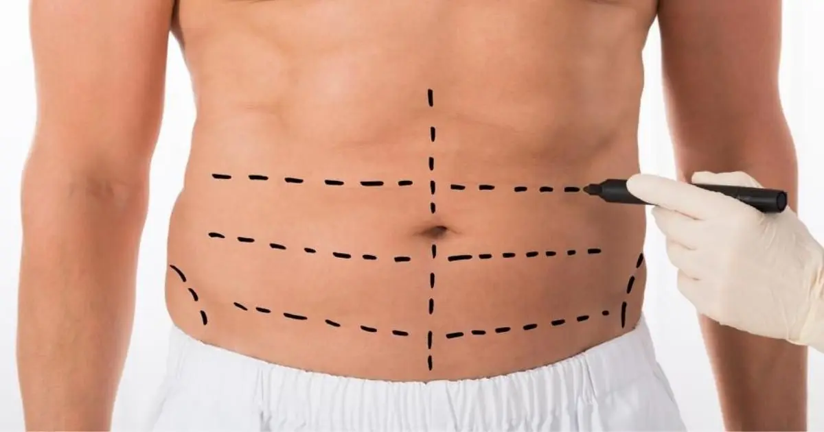 How to Find the Right Specialists for Six Pack Abs in Dubai