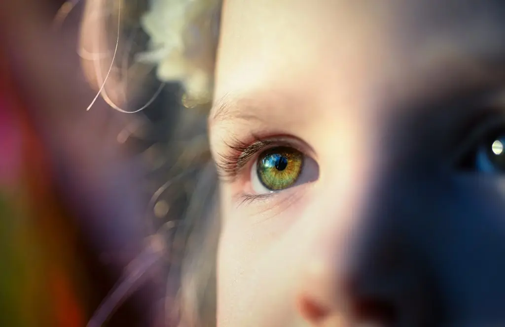 Squint and Paediatric Ophthalmology