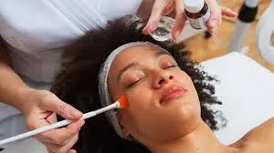 Chemical Peel Treatment