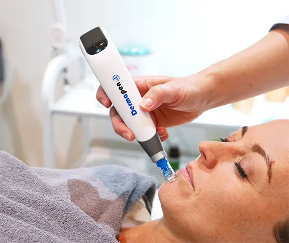 How Does Dermapen Microneedling Improve Skin Texture Naturally?