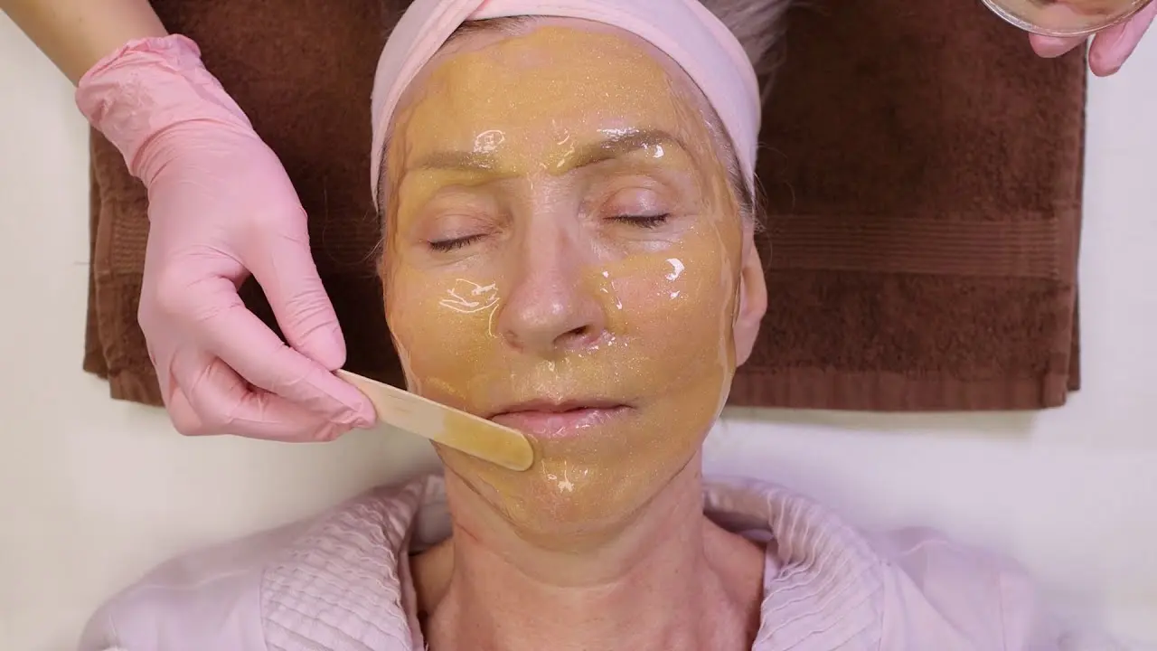 How Does Cosmelan Peel Treatment Improve Skin Tone?