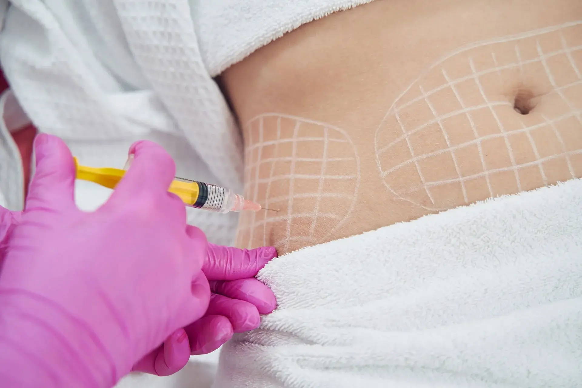 Can Fat Melting Injections Improve Body Proportions?
