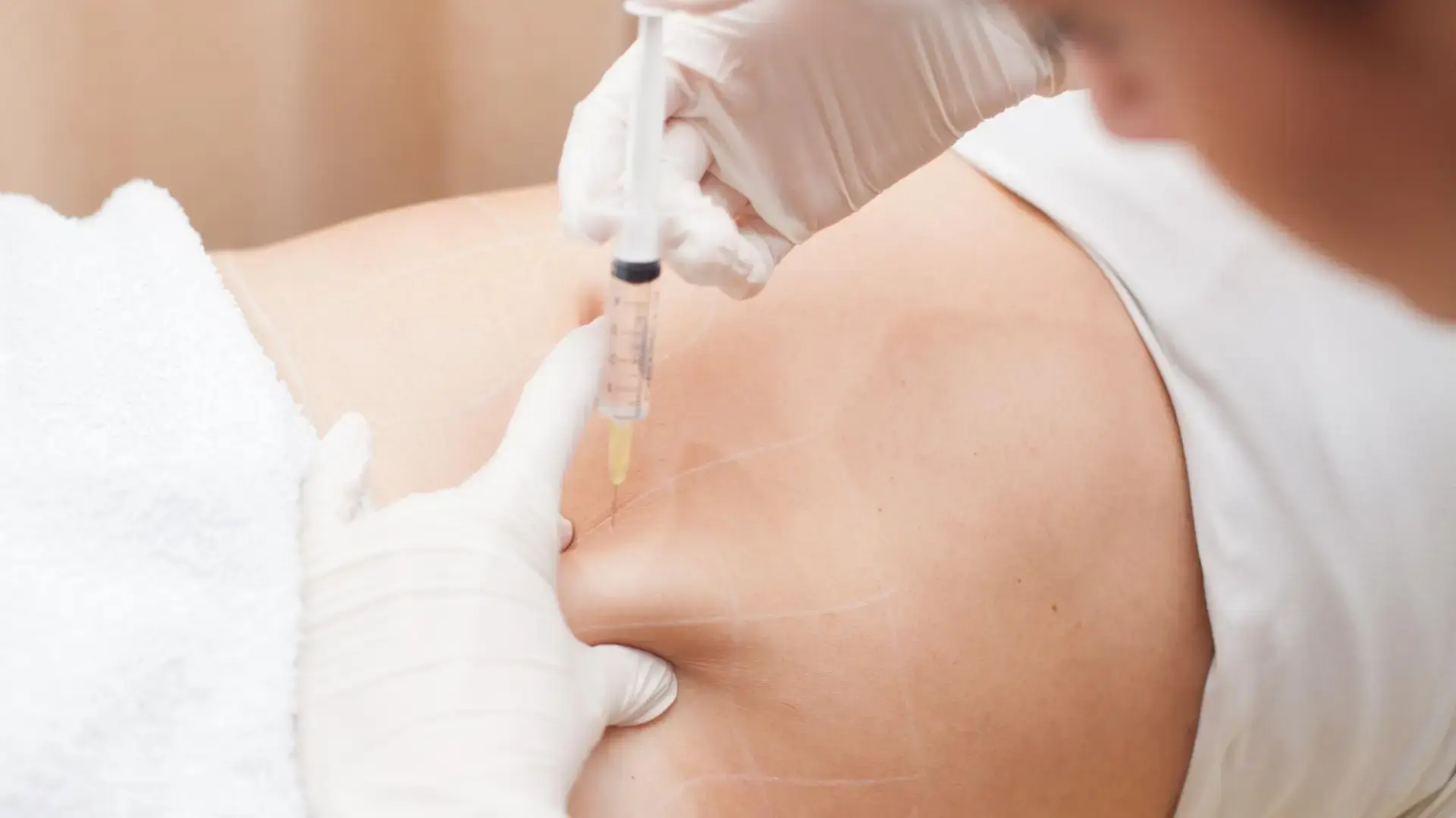 How Does Aqualyx Injection Work on Localized Fat?