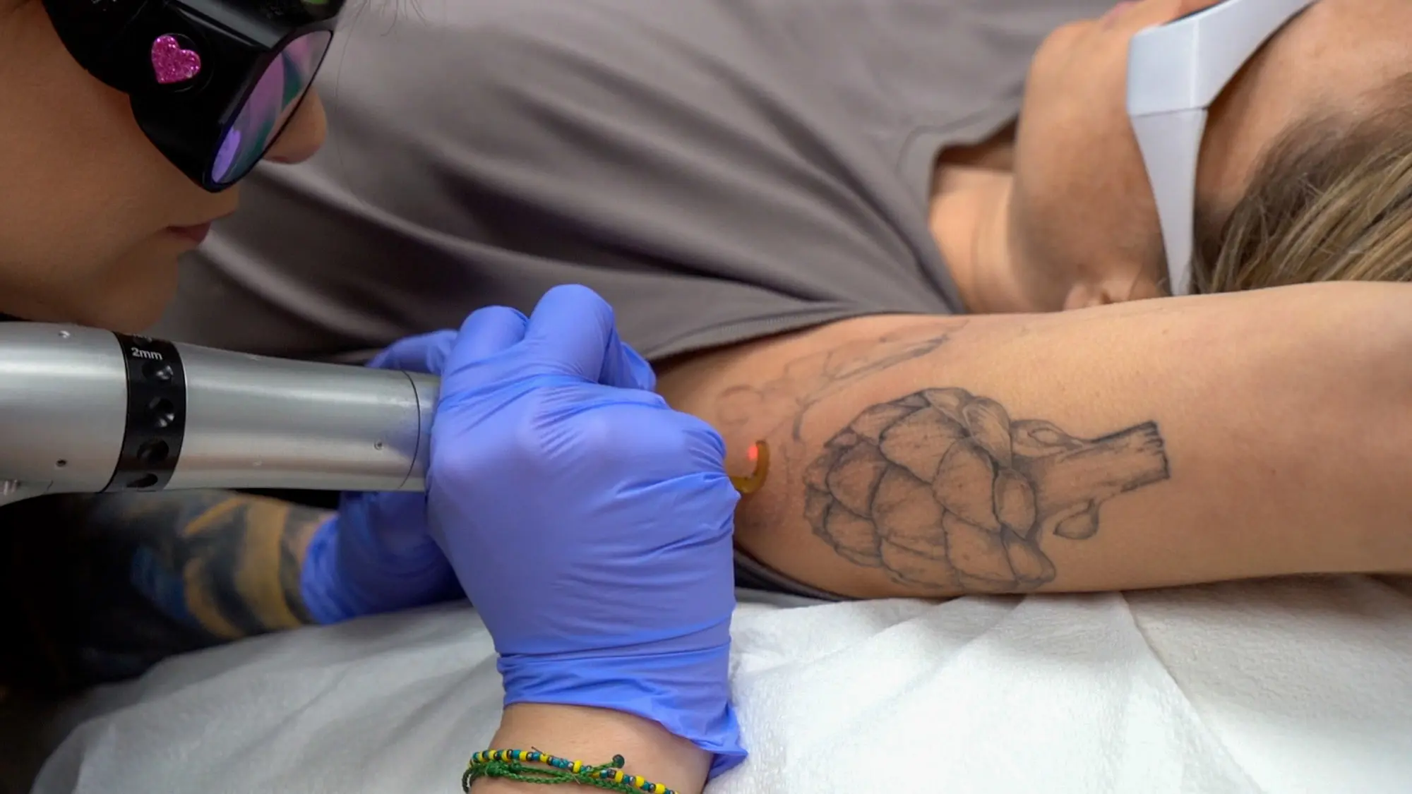 What Makes Laser Tattoo Removal Effective for Tattoo Fading?