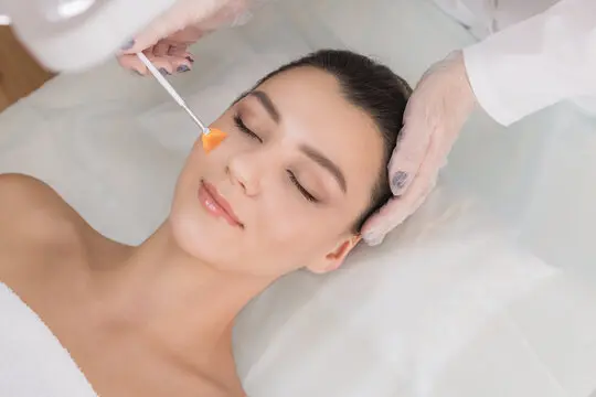 Can Chemical Peel Treatment Help Control Acne and Inflammation?