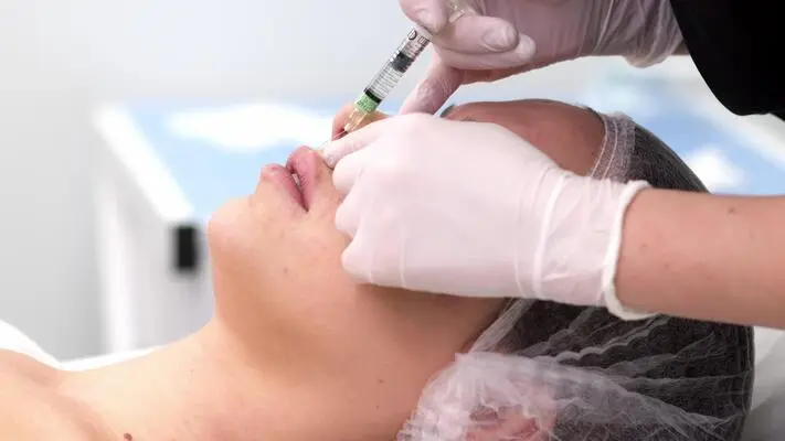 Why Is Lip Flip Trending for Natural Lip Enhancement?