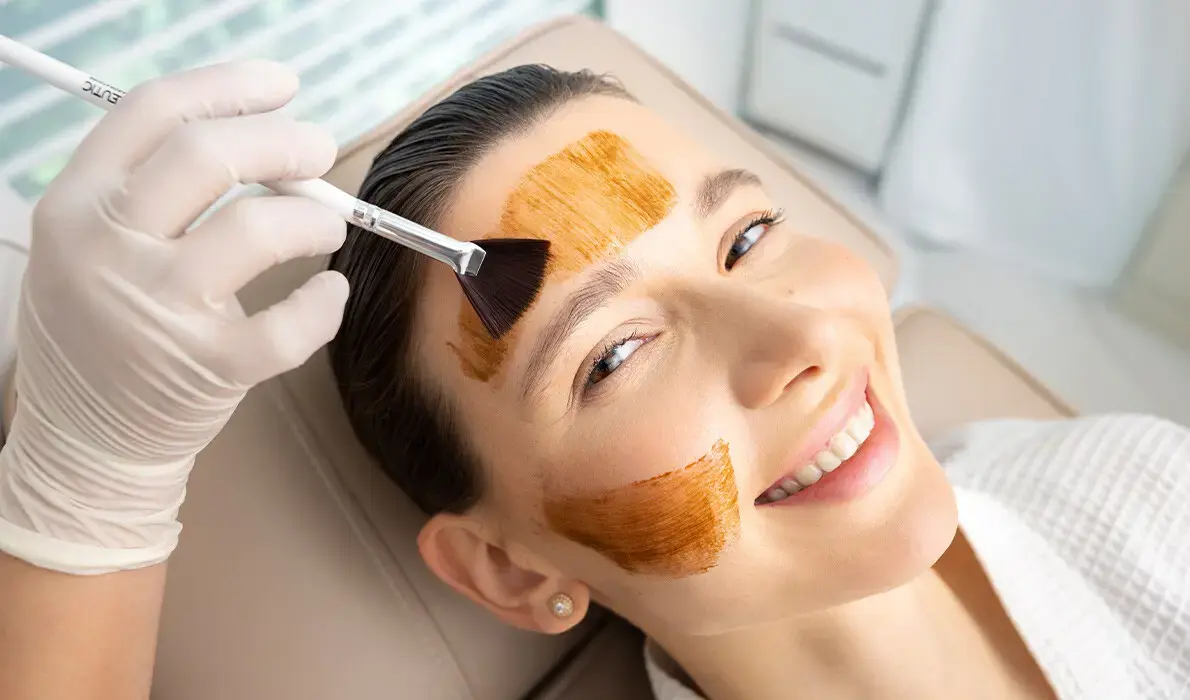 How Can Cosmelan Peel Reduce Skin Discoloration?