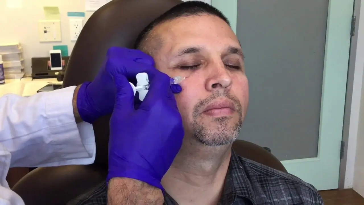 Is Under-Eye Filler Treatment Ideal for Tired-Looking Eyes?