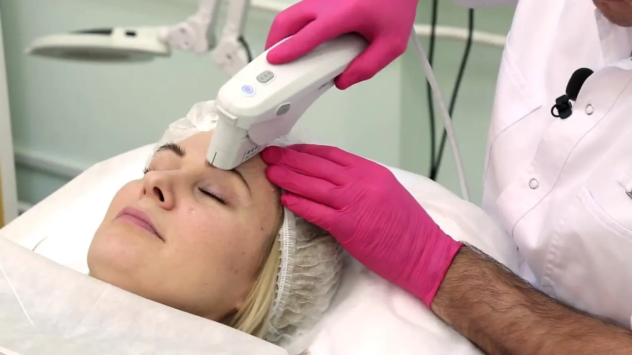 Can Pico Laser Treatment Reduce Persistent Skin Discoloration?