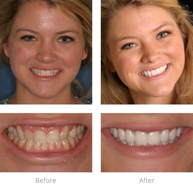 Cosmetic correction