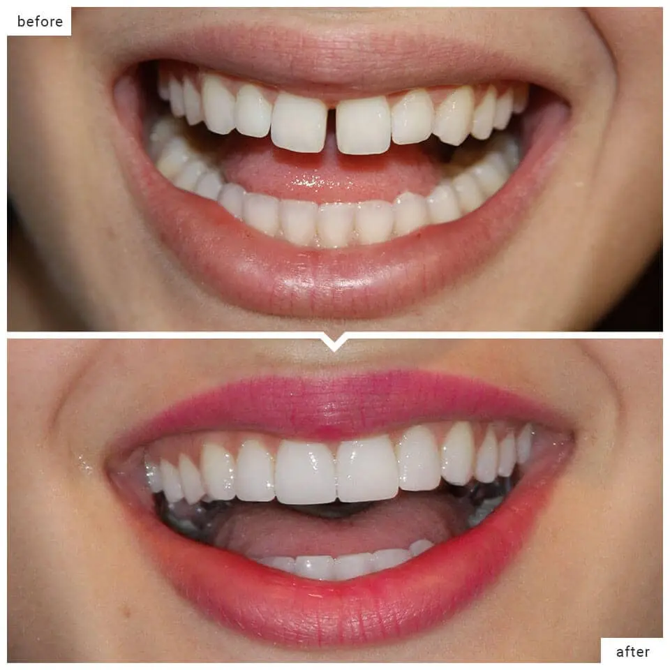 Instant Space Correction