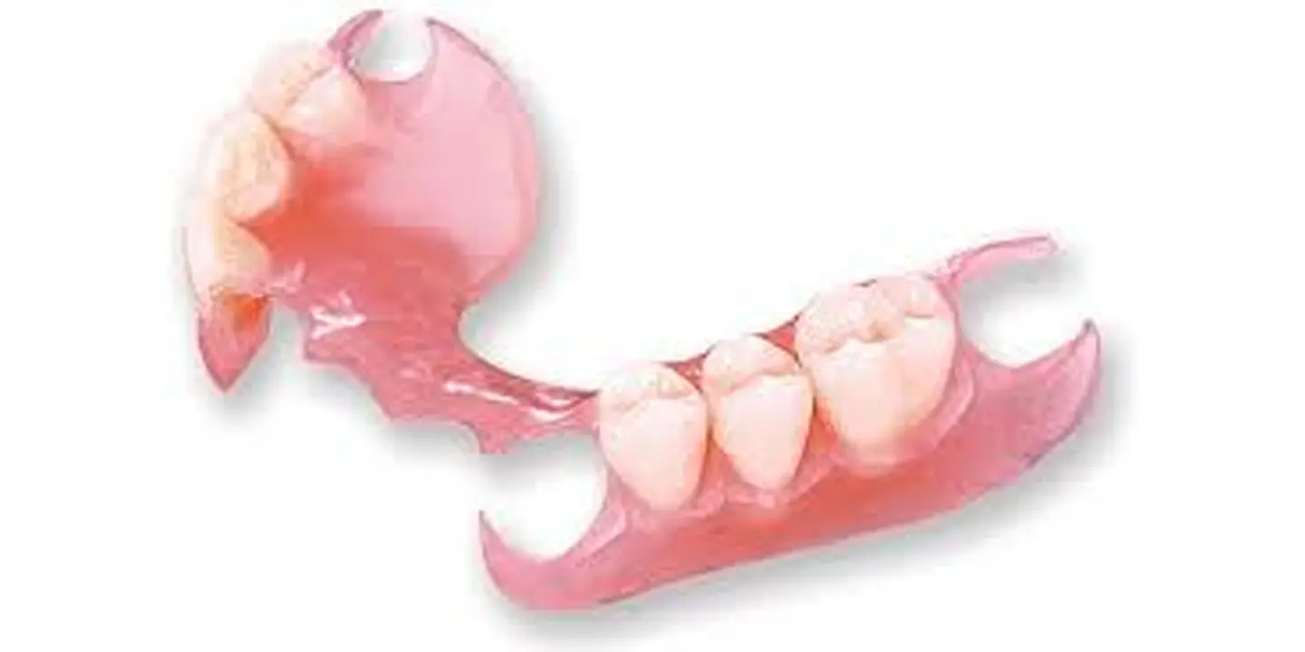 Removable Partial Denture