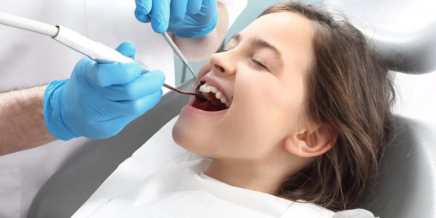 Dental Fillings