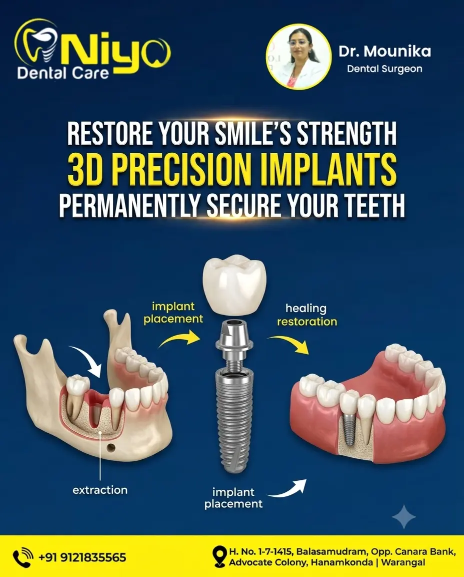 Permanent Dental Implants at Niyo Dental Care | Restore Your Smile