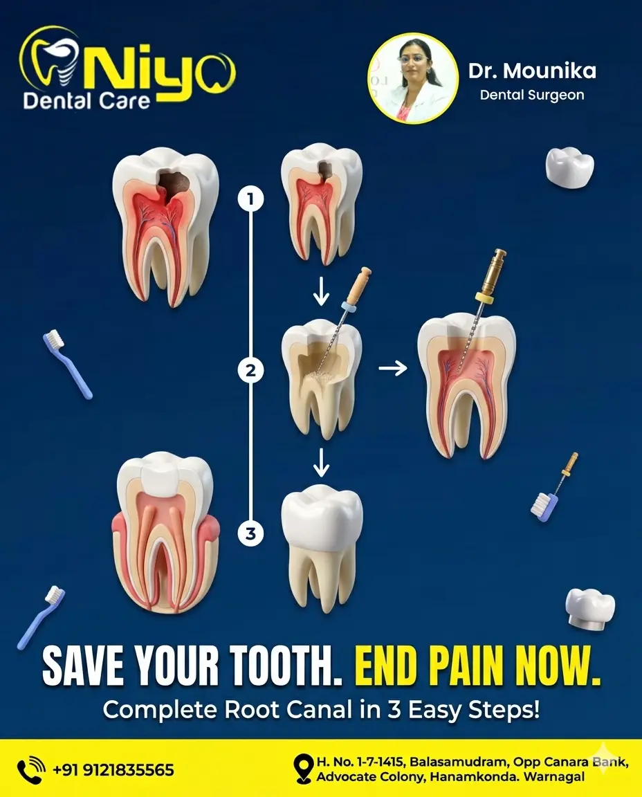 Say Goodbye to Tooth Pain with Expert Root Canal Treatment (RCT) at Niyo Dental Care!