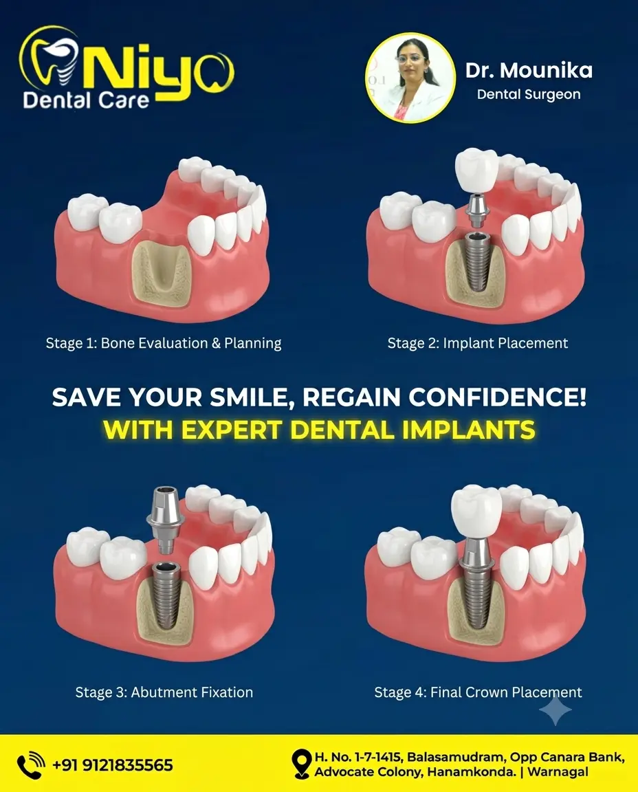 Restore Your Smile & Confidence with Permanent Dental Implants at Niyo Dental Care!