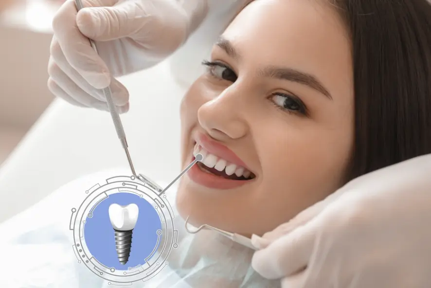 Dental Implants