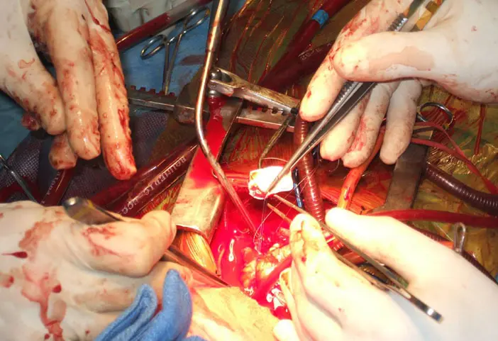 Heart Institute