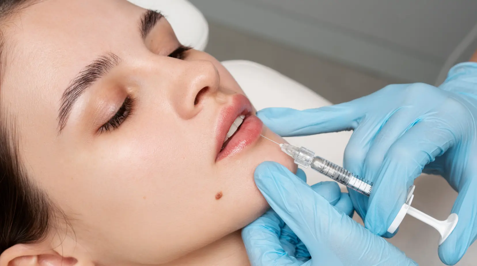How Long Do Lip Filler Injections Really Last?