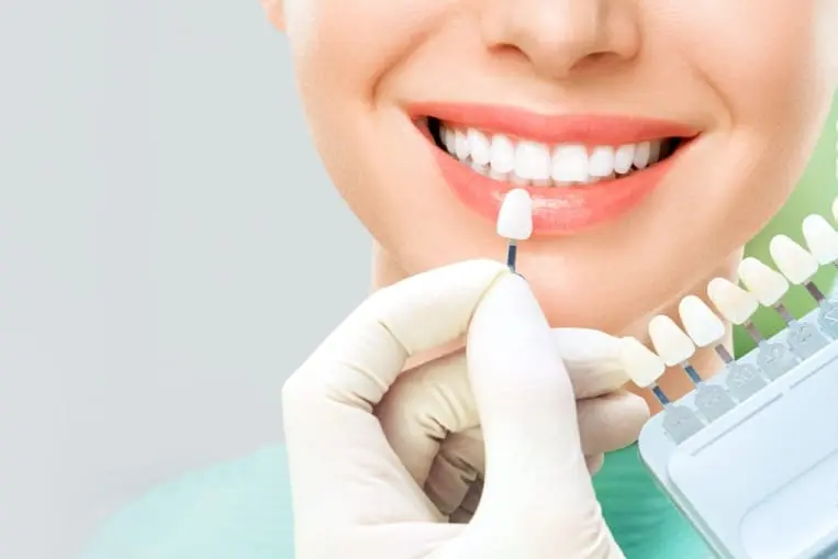 How Do Dental Veneers Help with Gaps Between Teeth?