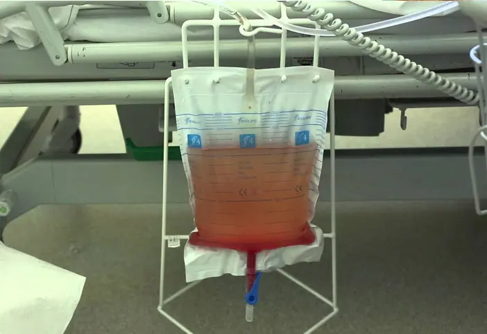 Remove urine and stool
