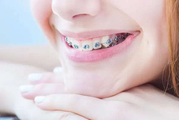 Orthodontics Treatments