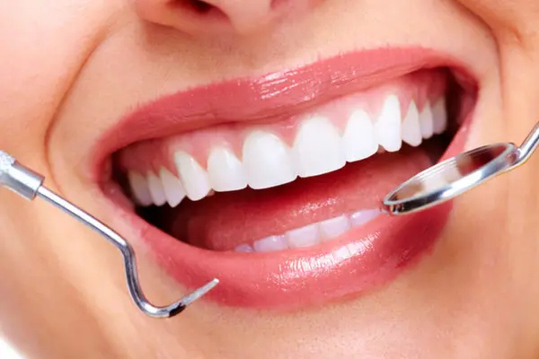 Costmetic Dentistry