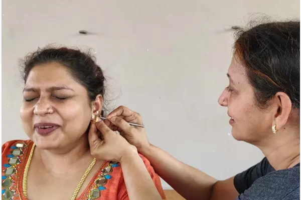 Auricular therapy