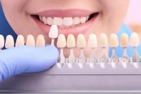 Cosmetic Fillings