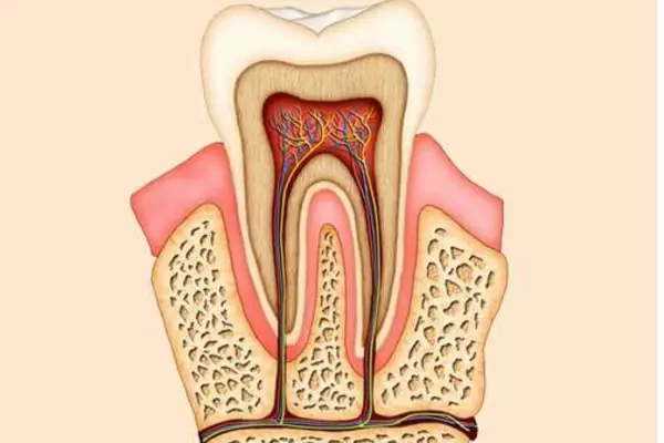 Root Canal Treatment