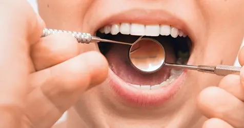 Dental implants