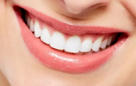 Teeth Whitening
