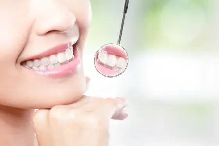 Veneer and Cosmetic Dentistry