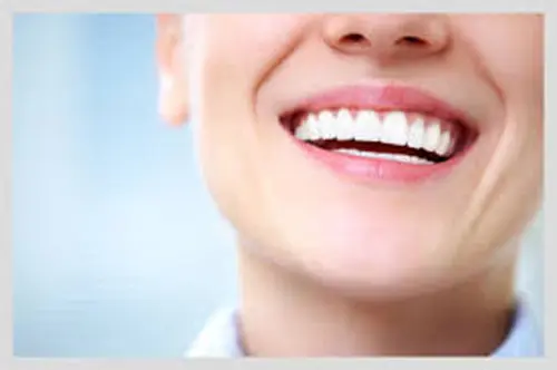 Dental Implant