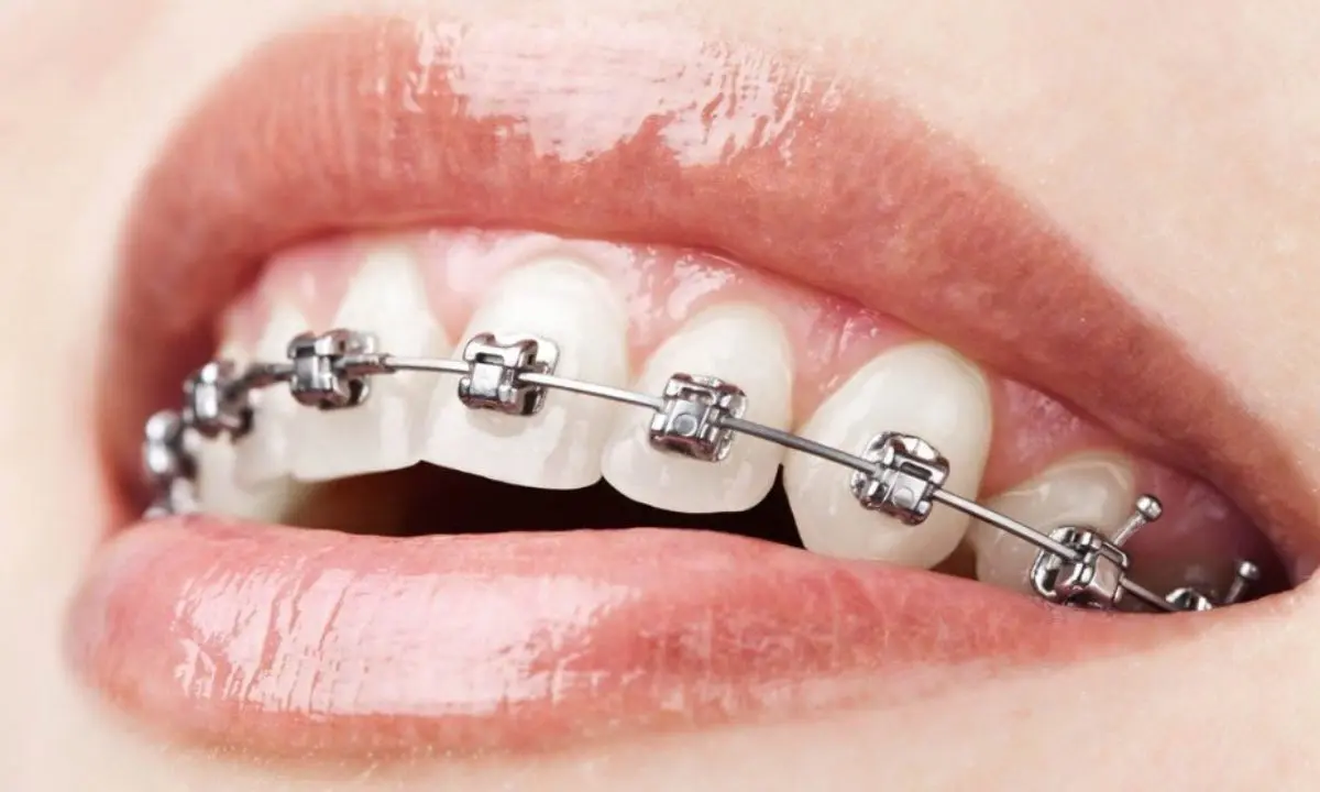 Orthodontics 