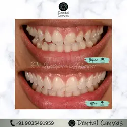  Smile Makeovers