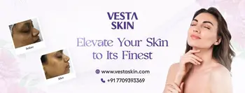 Vesta Skin Clinic