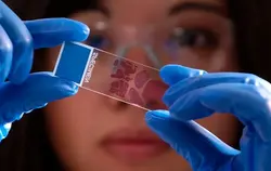 Pathology
