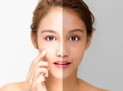 Skin Whitening Treatment