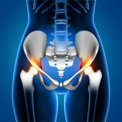 Total Hip Replacement 